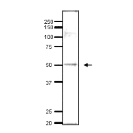 Detection of endonenous Ada2 in whole cell extract of S. cerevisiae by Western blotting, using the anti-Ada2 antibody. The antibody was used at 1/500 dilution. As second antibody, HRP-conjugated goat anti-rabbit IgG was used at 1/10,000