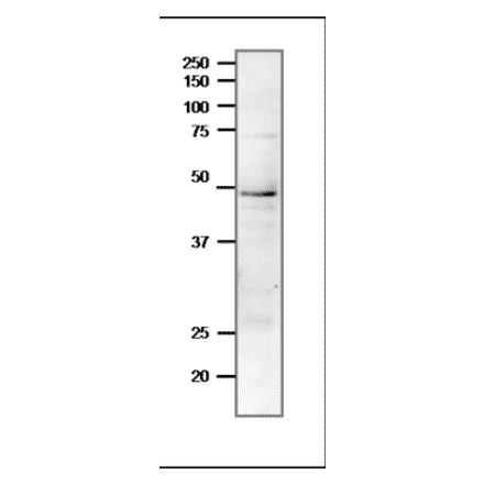 Western blot of endogenous Rad51 protein in crude extract of S. cerevisiae. Proteins in the extract were separated on 12.5% SDS-PAGE and transferred to membrane in wet system overnight. The antibody was used at 1:1,000 dilution. The secondary antibody, Goat Anti-Rabbit IgG Antibody (HRP) was used at 1:10,000 dilution.
