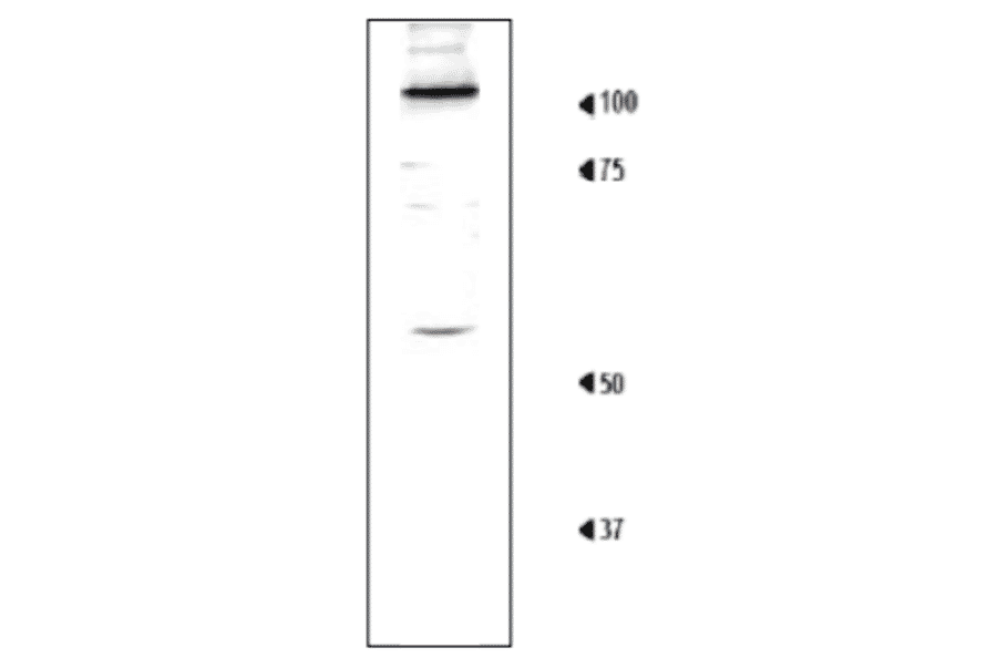 Detection of Rpn1 in the crude extract of S. cerevisiae by Western blotting using this antibody. 