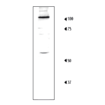 Detection of Rpn1 in the crude extract of S. cerevisiae by Western blotting using this antibody. 