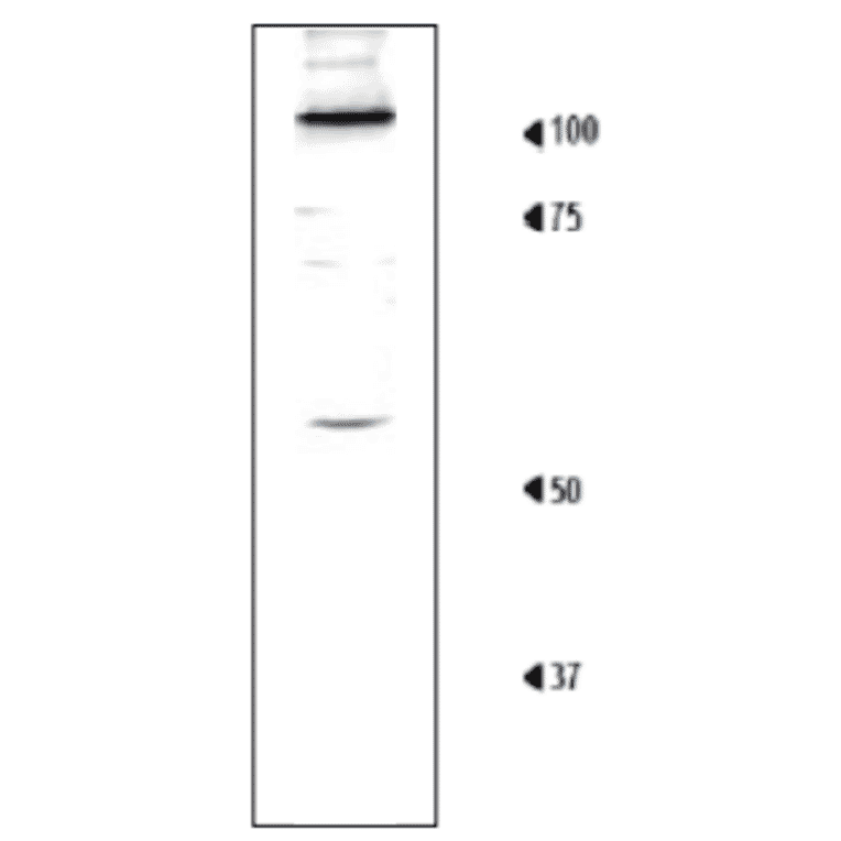 Detection of Rpn1 in the crude extract of S. cerevisiae by Western blotting using this antibody. 