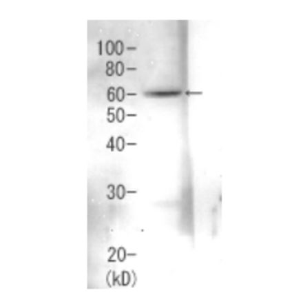 Detection of Rpn3 (60kDa) in the crude extract of S. cerevisiae by Western blotting using this antibody.