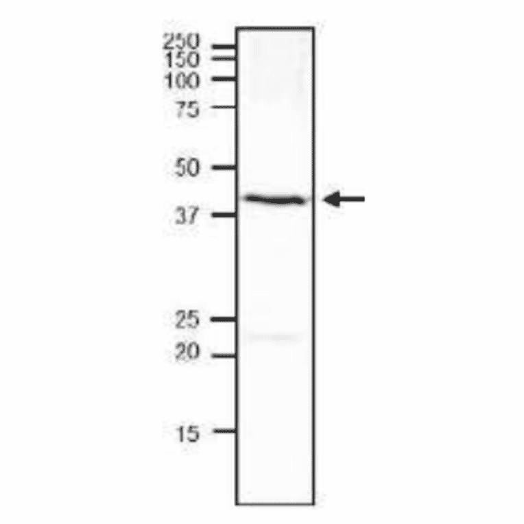 Western blot of endogenous Rqn1 in S. cerevisiae.