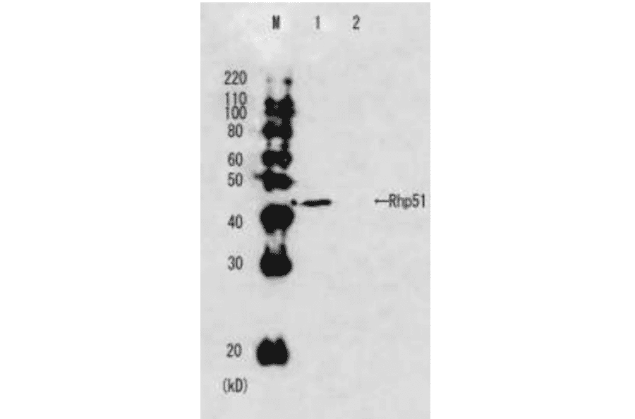 Western blot analysis of Rhp51 in the whole cell extracts. M: Molecular size markers (kD). Lane 1: Wild-type strain. Lane2: Rhp51 deletion mutant strain.
