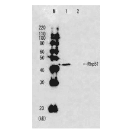 Western blot analysis of Rhp51 in the whole cell extracts. M: Molecular size markers (kD). Lane 1: Wild-type strain. Lane2: Rhp51 deletion mutant strain.