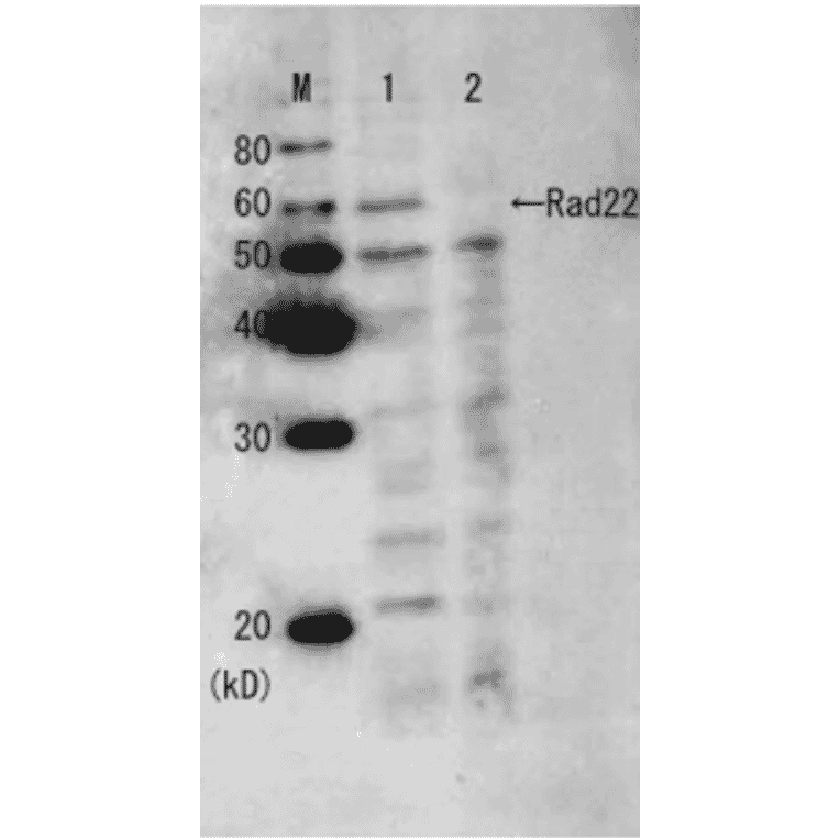 Western blot analysis of Rad22 protein in the whole cell extracts with Anti-Rad22 Antiserum (before affinity purification). M: Molecular weight markers (kD). Lane 1: Wild-type strain. Lane 2: Rad22 deletion mutant strain.