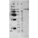 Western blot analysis of Rad22 protein in the whole cell extracts with Anti-Rad22 Antiserum (before affinity purification). M: Molecular weight markers (kD). Lane 1: Wild-type strain. Lane 2: Rad22 deletion mutant strain.