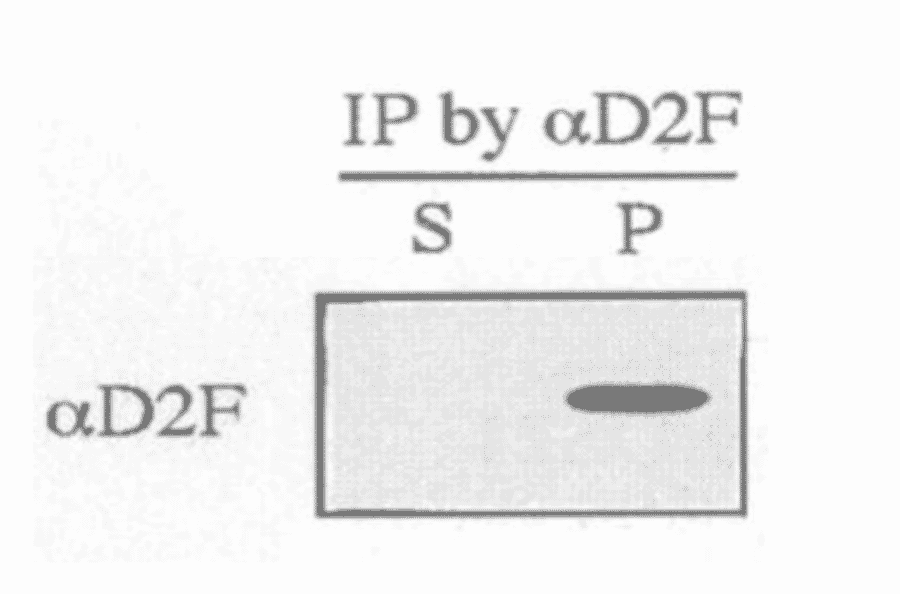 Immunoprecipitation of wild-type S. pombe extracts was performed using anti-dis2 antibody, D2F (ref.3). Resulting immunoprecipitate (P) and supernatant (S) were immunoblotted by anti-dis2 antibody
