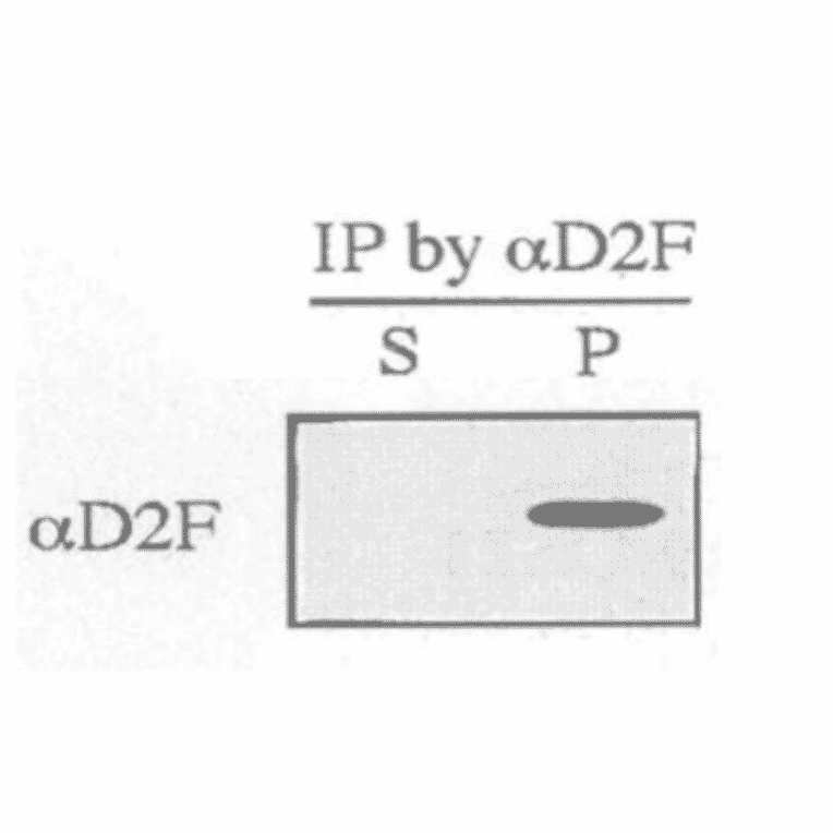 Immunoprecipitation of wild-type S. pombe extracts was performed using anti-dis2 antibody, D2F (ref.3). Resulting immunoprecipitate (P) and supernatant (S) were immunoblotted by anti-dis2 antibody