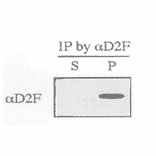 Immunoprecipitation of wild-type S. pombe extracts was performed using anti-dis2 antibody, D2F (ref.3). Resulting immunoprecipitate (P) and supernatant (S) were immunoblotted by anti-dis2 antibody