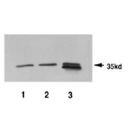 Identification of Pad1 protein in crude extracts by anti-Pad1 antiserum