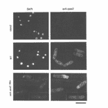 Cellular location of Ppa1 and Ppa2