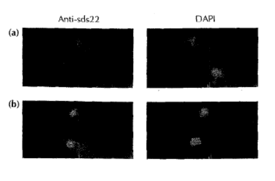 Sds22 subcellular localization