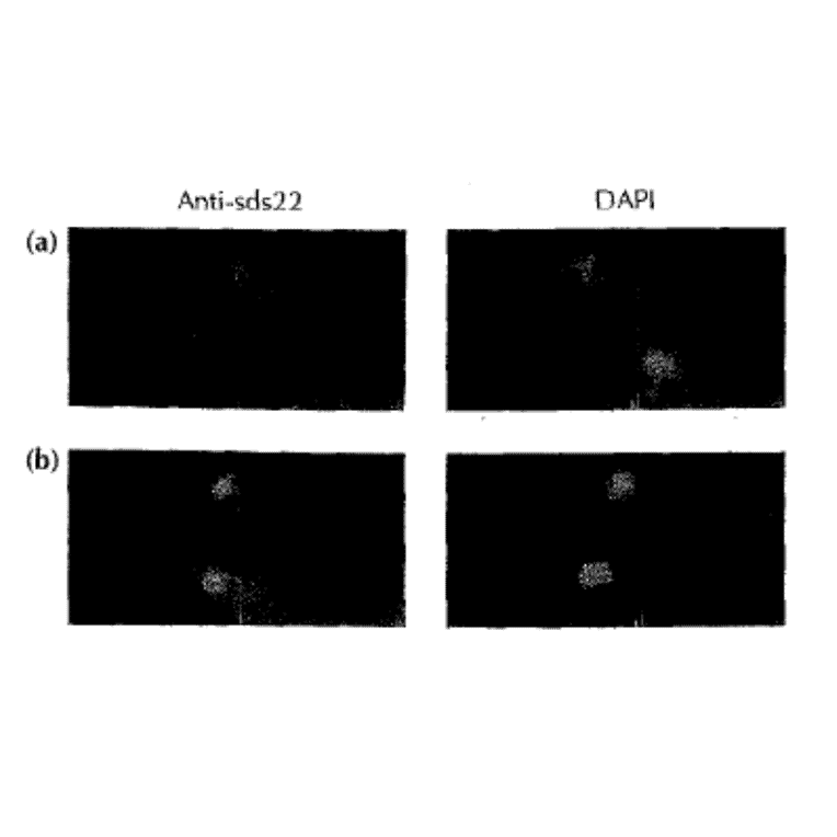 Sds22 subcellular localization