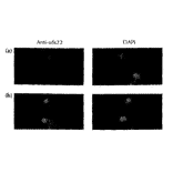 Sds22 subcellular localization