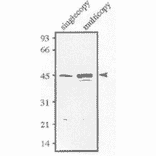 dentification of Sds23 protein.