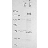 Western blot analysis of Mrc1 in the whole cell extracts. Lane 1: mrc- strain Lane 2: Wild type strain