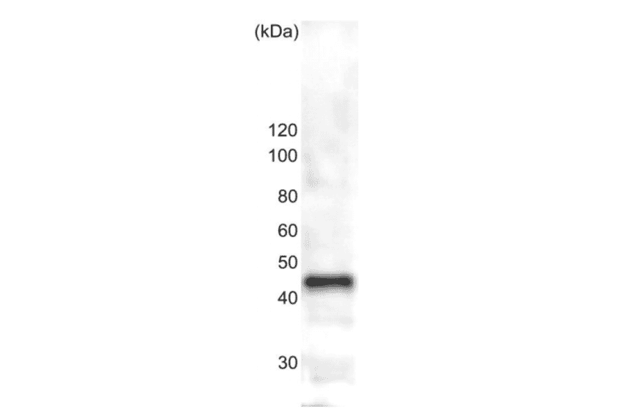 Western blot analysis of ßtubulin in the whole cell extracts of S. pombe (10?g). Ant-? tublin antibody: 1,000 fold dilution