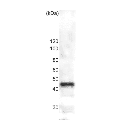 Western blot analysis of ßtubulin in the whole cell extracts of S. pombe (10?g). Ant-? tublin antibody: 1,000 fold dilution