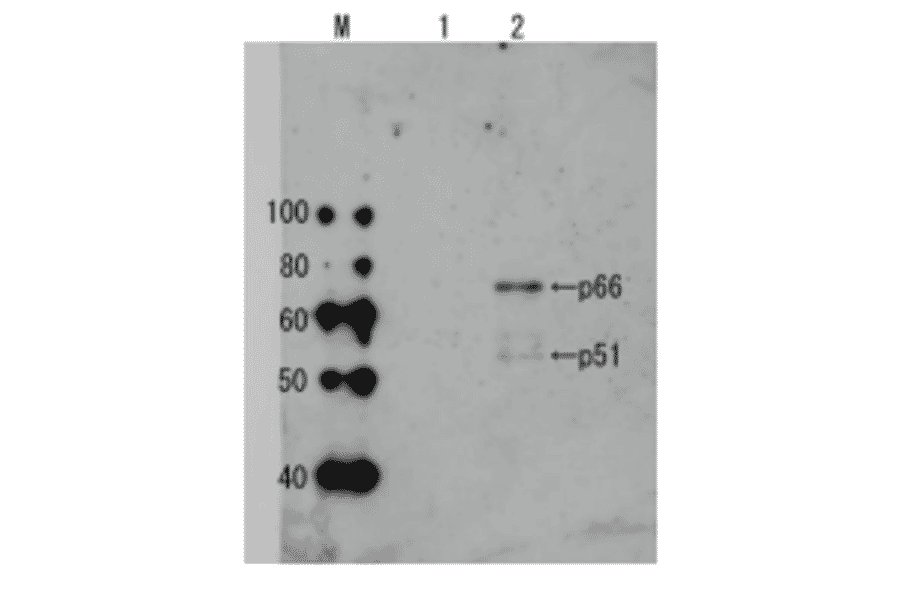 Detection of HIV-1 reverse transcriptase in the extract of HIV-1 infected cells by Western blotting using anti-HIV transcriptase antibody.