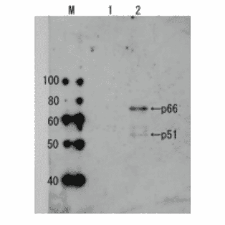 Detection of HIV-1 reverse transcriptase in the extract of HIV-1 infected cells by Western blotting using anti-HIV transcriptase antibody.