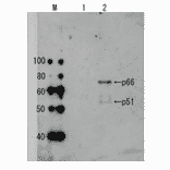 Detection of HIV-1 reverse transcriptase in the extract of HIV-1 infected cells by Western blotting using anti-HIV transcriptase antibody.