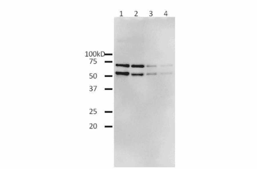 Western blotting of functional recombinant full-length HIV-1 reverse transcriptase (BioAcademia 05-001) by using anti-HIV-1 Reverse Transriptase antibody.