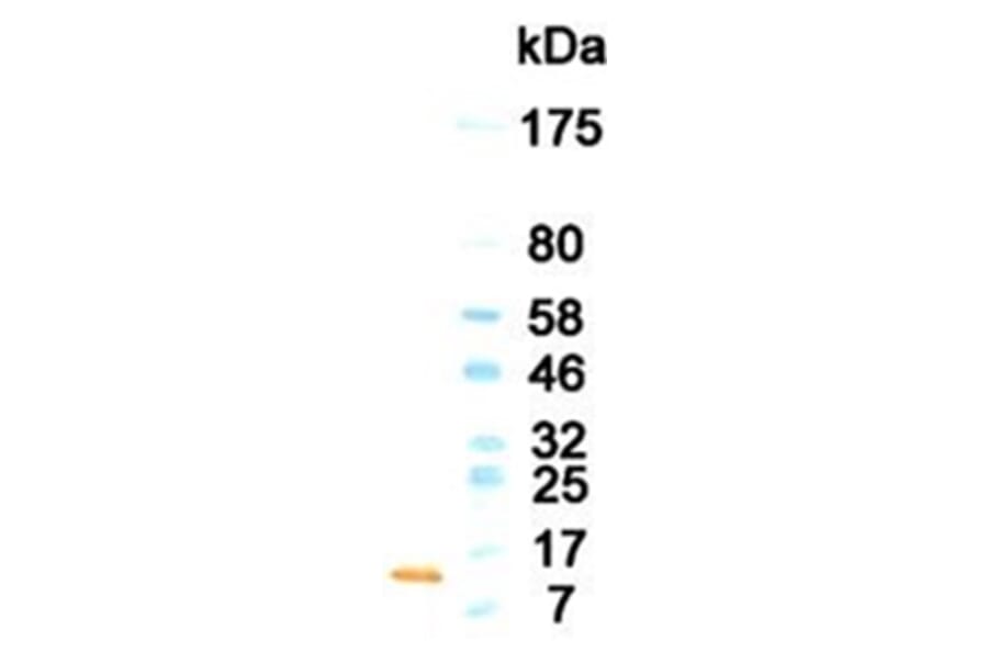 Western Blot - Anti-GM-CSF Antibody (HRP) (010701G03H) - Antibodies.com