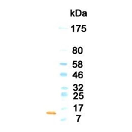 Western Blot - Anti-GM-CSF Antibody (HRP) (010701G03H) - Antibodies.com