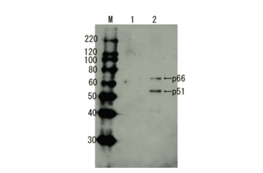Detection of HIV-1 reverse transcriptase by Western blotting using anti-HIV transcriptase antibody.