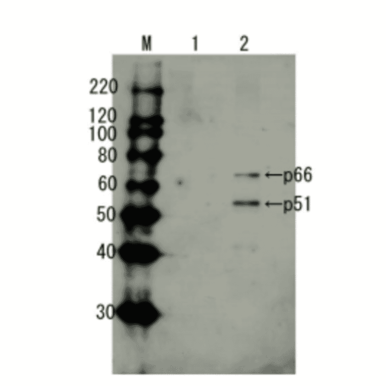 Detection of HIV-1 reverse transcriptase by Western blotting using anti-HIV transcriptase antibody.