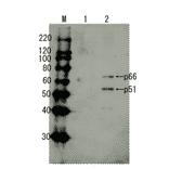 Detection of HIV-1 reverse transcriptase by Western blotting using anti-HIV transcriptase antibody.