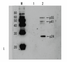 Detection of HIV-1 p24 and precursor proteins p55 and p41 by Western blotting using the anti p24 antibody. 