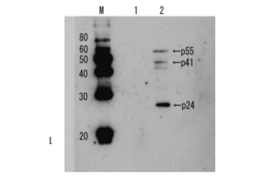 Detection of HIV-1 p24 and precursor proteins p55 and p41 by Western blotting using the anti p24 antibody. 