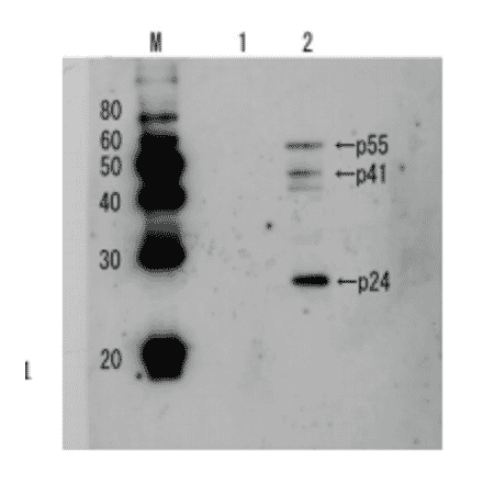 Detection of HIV-1 p24 and precursor proteins p55 and p41 by Western blotting using the anti p24 antibody. 