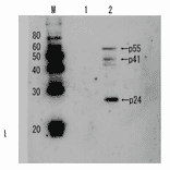 Detection of HIV-1 p24 and precursor proteins p55 and p41 by Western blotting using the anti p24 antibody. 