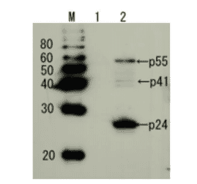 Detection of HIV-1 p24 and precursor proteins p55 and p41 by Western blotting using the anti-p24 antibody.
