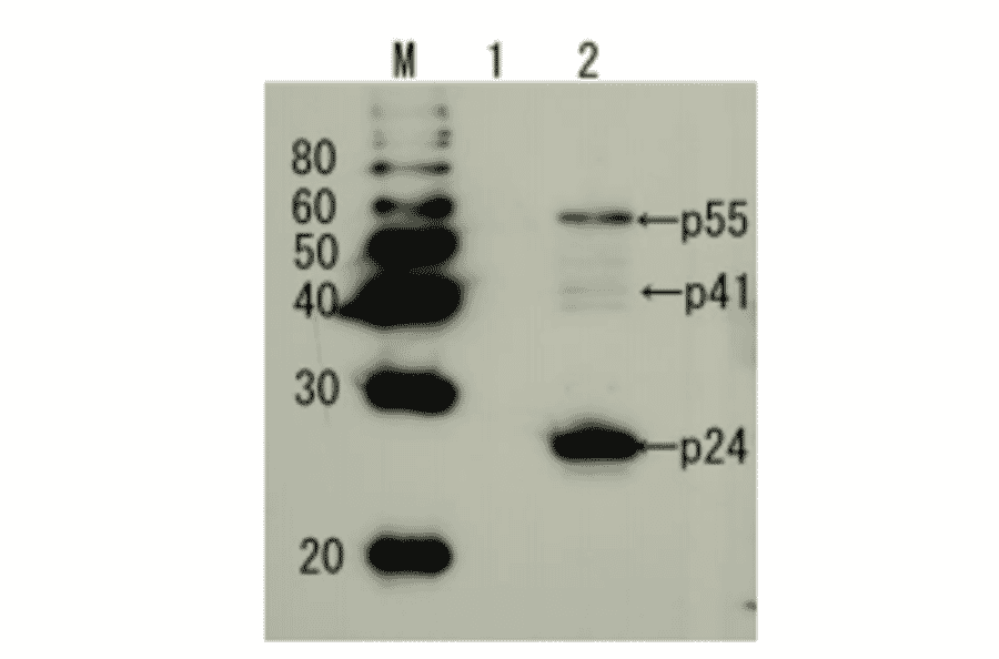 Detection of HIV-1 p24 and precursor proteins p55 and p41 by Western blotting using the anti-p24 antibody.
