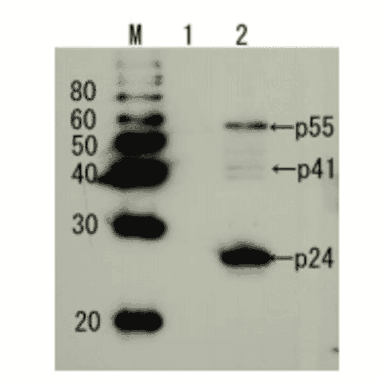 Detection of HIV-1 p24 and precursor proteins p55 and p41 by Western blotting using the anti-p24 antibody.