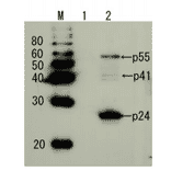 Detection of HIV-1 p24 and precursor proteins p55 and p41 by Western blotting using the anti-p24 antibody.