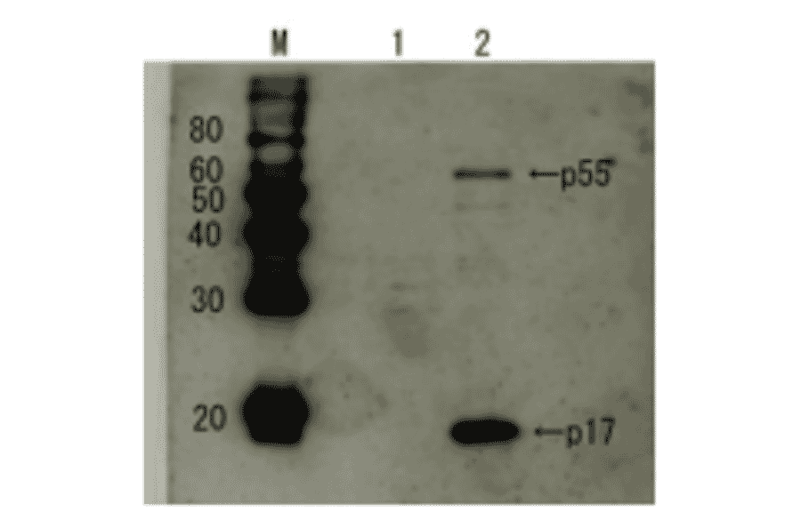 Detection of HIV-1 p17 and its p55 precursor protein by Western blotting using the anti-p17 antibody.