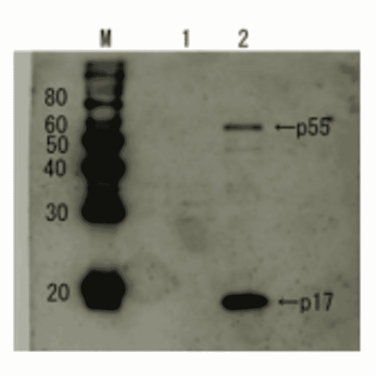 Detection of HIV-1 p17 and its p55 precursor protein by Western blotting using the anti-p17 antibody.