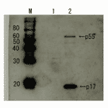 Detection of HIV-1 p17 and its p55 precursor protein by Western blotting using the anti-p17 antibody.