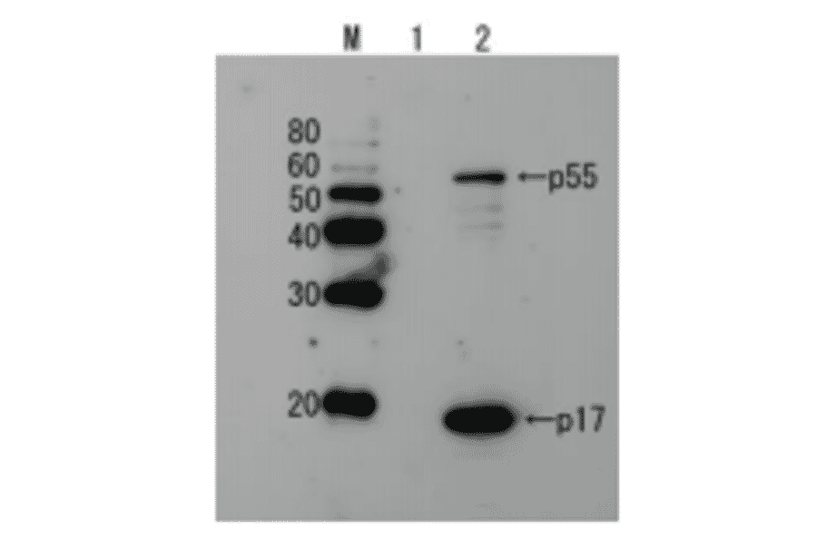Detection of HIV-1 p17 and its p55 precursor protein by Western blotting using the anti-p17 antibody.