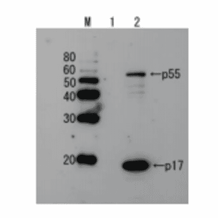 Detection of HIV-1 p17 and its p55 precursor protein by Western blotting using the anti-p17 antibody.