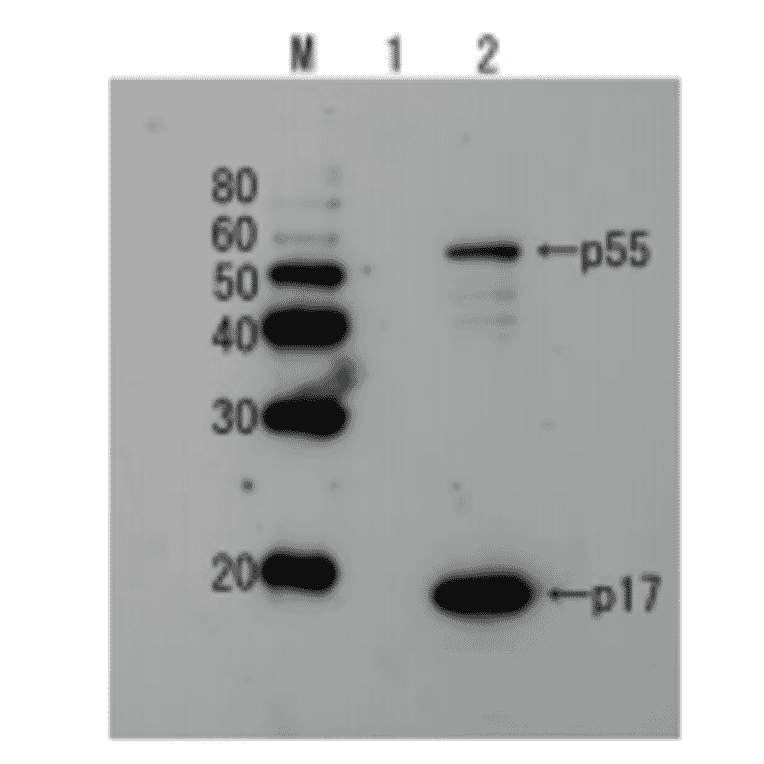 Detection of HIV-1 p17 and its p55 precursor protein by Western blotting using the anti-p17 antibody.