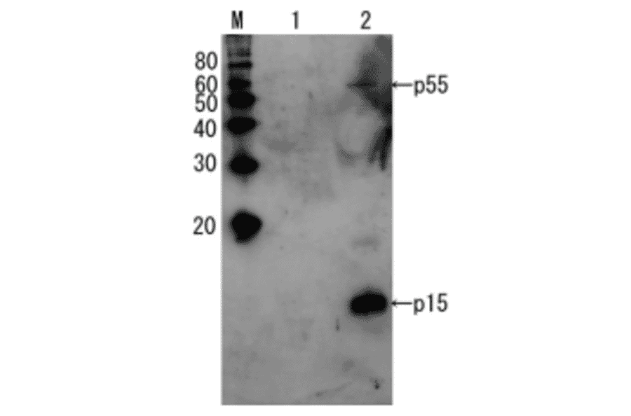 Detection of HIV-1 p15 and its p55 precursor protein by Western blotting using the anti-p15 antibody.