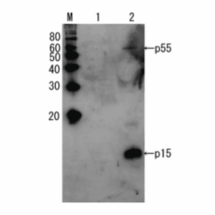 Detection of HIV-1 p15 and its p55 precursor protein by Western blotting using the anti-p15 antibody.