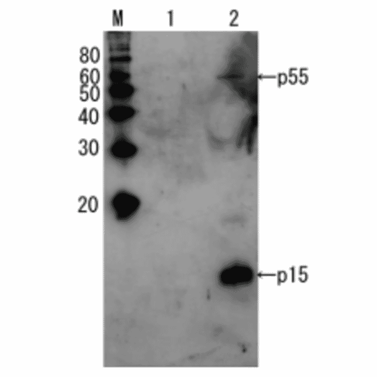 Detection of HIV-1 p15 and its p55 precursor protein by Western blotting using the anti-p15 antibody.