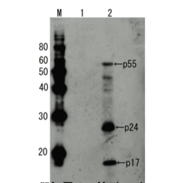 Detection of HIV-1 p55 by Western blotting using the anti-p55 antibody.